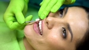 What is the difference between dental veneers and dental implants?