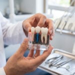 Why See an FICOI Dentist Instead of Being Referred to an Oral Surgeon?