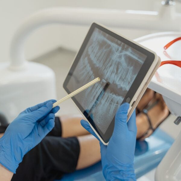 Root Canal vs. Tooth Extraction: Which Option Is Right for You?
