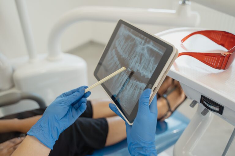 root canal vs. tooth extraction
