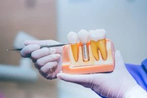 Radiant Dentistry - Dental Implants