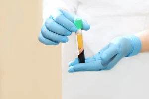 Radiant Dentistry - Platelet Rich Plasma